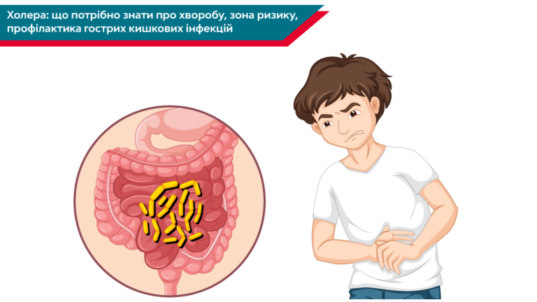 Що таке холера: причини, симптоми та лікування